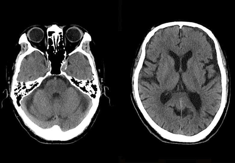 Routine brain