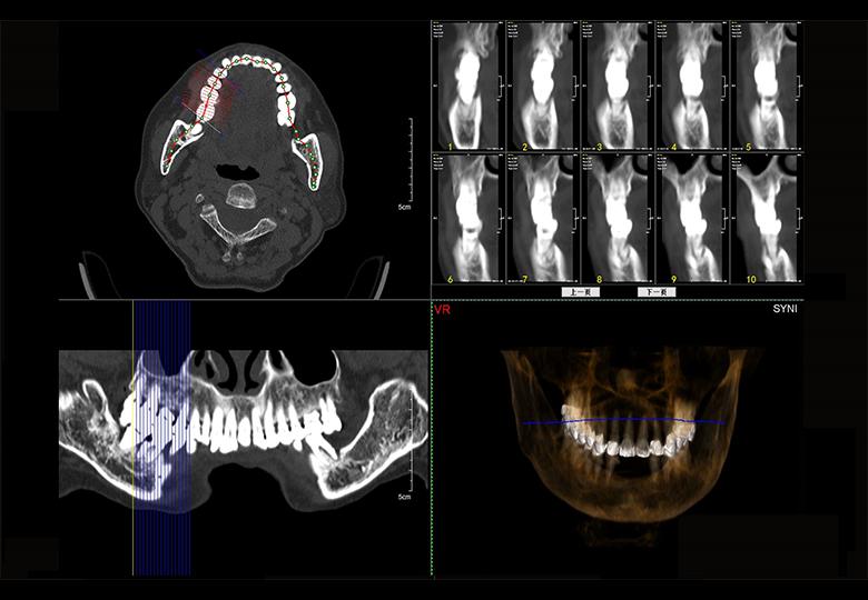 Dental analysis