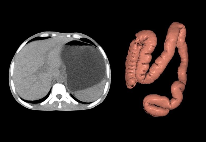 Abdomen Scan